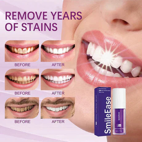 Hismile v34 Color Corrector Purple Teeth Whitening Toothpaste Kit without Toothbrush Pen Strips